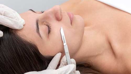 Dermaplaning